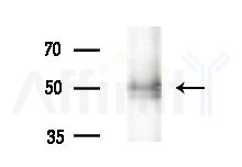 BLK Antibody - Western blot analysis of extracts from EC304 cells(heat-shock treatment), using BLK Antibody at 1/1000 dilution.