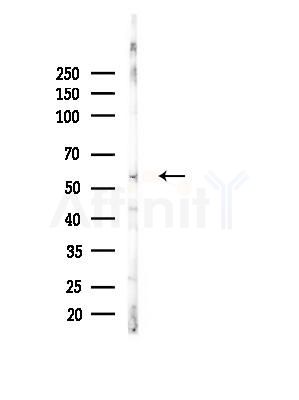 BLK Antibody - Western blot analysis of lysates from EC304 cells(heat-shock, 45min treatment), using BLK Antibody at 1/1000 dilution.