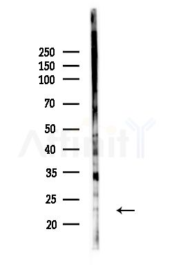 R-Ras Antibody - Western blot analysis of lysates from MCF7 cells(heat-shock,45min treatment), using R-Ras Antibody at 1/1000 dilution.