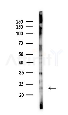 R-Ras Antibody - Western blot analysis of lysates from COLO205 cells(UV,30min treatment), using R-Ras Antibody at 1/1000 dilution.