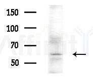 DYRK2/4 Antibody - Western blot analysis of extracts from HepG2 cells(serum starvation treatment), using DYRK2/4 Antibody at 1/1000 dilution.