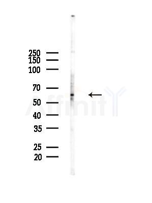 DYRK2/4 Antibody - Western blot analysis of lysates from HepG2 cells(starvation treatment), using DYRK2/4 Antibody at 1/1000 dilution.