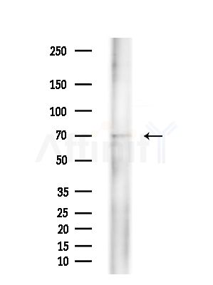 MAP3K2 Antibody - Western blot analysis of extracts from EC304 cells(heat-shock treatment), using MAP3K2 Antibody at 1/1000 dilution.