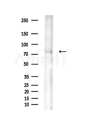 NuaK1 Antibody - Western blot analysis of extracts from EC304 cells(heat-shock treatment), using NuaK1 Antibody at 1/1000 dilution.