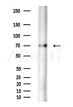 NuaK1 Antibody - Western blot analysis of extracts from B16F10-LUC cells(starvation treatment), using NuaK1 Antibody at 1/1000 dilution.