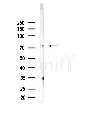 NuaK1 Antibody - Western blot analysis of lysates from B16F10-LUC cells(starvation,24h treatment), using NuaK1 Antibody at 1/1000 dilution.