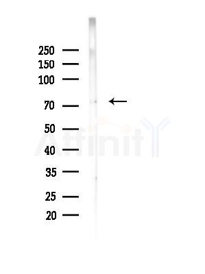 NuaK1 Antibody - Western blot analysis of lysates from EC304 cells(heat-shock, 45min treatment), using NuaK1 Antibody at 1/1000 dilution.