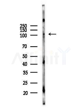 EPH B1/3/4 Antibody - Western blot analysis of lysates from Mouse testis, using EPH B1/3/4 Antibody at 1/1000 dilution.