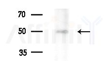 STYK1/NOK Antibody - Western blot analysis of extracts from EC304 cells(heat-shock treatment), using STYK1/NOK Antibody at 1/1000 dilution.