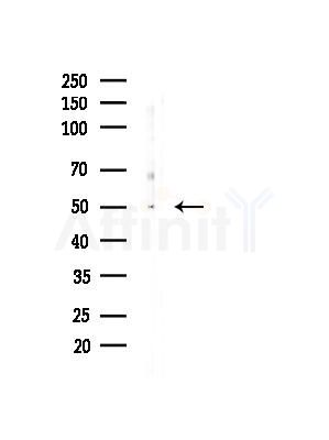 STYK1/NOK Antibody - Western blot analysis of lysates from EC304 cells(heat-shock, 45min treatment), using STYK1/NOK Antibody at 1/1000 dilution.
