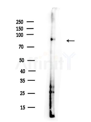 IFT88 Antibody - Western blot analysis of lysates from A375 cells(heat-shock,45min treatment), using IFT88 Antibody at 1/1000 dilution.