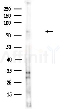 IFT88 Antibody - Western blot analysis of lysates from HUVEC cells(UV,30min treatment), using IFT88 Antibody at 1/1000 dilution.