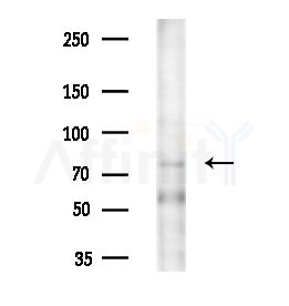CPT1A Antibody - Western blot analysis of extracts from EC304 cells(heat-shock treatment), using CPT1A Antibody at 1/1000 dilution.