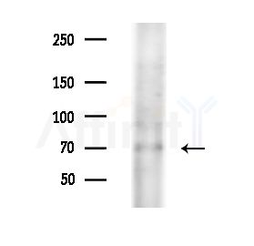 CPT1A Antibody - Western blot analysis of extracts from Mouse liver, using CPT1A Antibody at 1/1000 dilution.