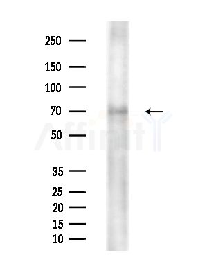 CPT1A Antibody - Western blot analysis of extracts from Rat brain, using CPT1A Antibody at 1/1000 dilution.