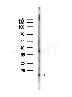FIS1 Antibody - Western blot analysis of lysates from COLO205 cells(heat-shock,45min treatment), using FIS1 Antibody at 1/1000 dilution.