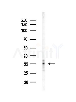 MFF Antibody - Western blot analysis of lysates from HUVEC cells(starvation,24h treatment), using MFF Antibody at 1/1000 dilution.