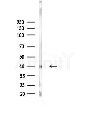 SHARPIN Antibody - Western blot analysis of lysates from Rat brain, using SHARPIN Antibody at 1/1000 dilution.