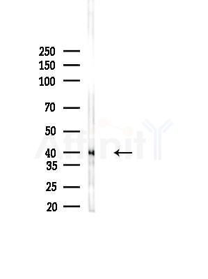 SHARPIN Antibody - Western blot analysis of lysates from B16F10-LUC cells(LPS,4h treatment), using SHARPIN Antibody at 1/1000 dilution.