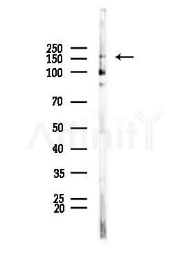 VPRBP Antibody - Western blot analysis of lysates from Rat brain, using VPRBP Antibody at 1/1000 dilution.