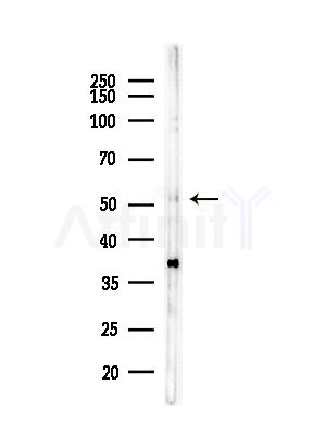 PFKFB3 Antibody - Western blot analysis of lysates from MDA-MB-231 cells(heat-shock,45min treatment), using PFKFB3 Antibody at 1/1000 dilution.