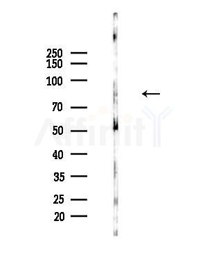 PLOD2 Antibody - Western blot analysis of lysates from LoVo cells(heat-shock,45min treatment), using PLOD2 Antibody at 1/1000 dilution.