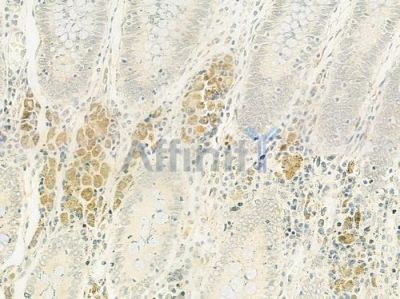 PLOD2 Antibody - DF12018 at 1/100 staining human normal colon tissue by IHC-P.