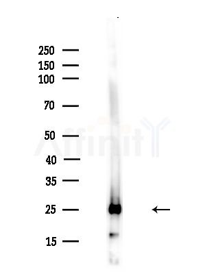 TPI1 Antibody - Western blot analysis of lysates from A375 cells(heat-shock,45min treatment), using TPI1 Antibody at 1/1000 dilution.