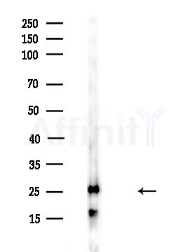 TPI1 Antibody - Western blot analysis of lysates from HUVEC cells(UV,30min treatment), using TPI1 Antibody at 1/1000 dilution.
