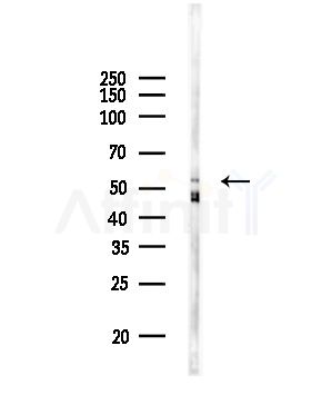 MKS1 Antibody - Western blot analysis of lysates from Rat brain, using MKS1 Antibody at 1/1000 dilution.