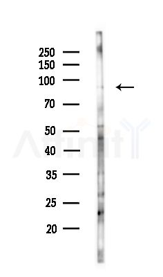 IFT81 Antibody - Western blot analysis of lysates from COLO205 cells(UV,30min treatment), using IFT81 Antibody at 1/1000 dilution.