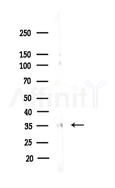PRKCDBP Antibody - Western blot analysis of lysates from COLO205 cells(heat-shock,45min treatment), using PRKCDBP Antibody at 1/1000 dilution.