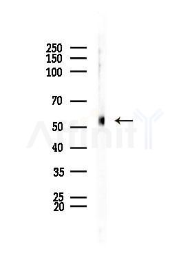 TMPRSS4 Antibody - Western blot analysis of lysates from Rat brain, using TMPRSS4 Antibody at 1/1000 dilution.
