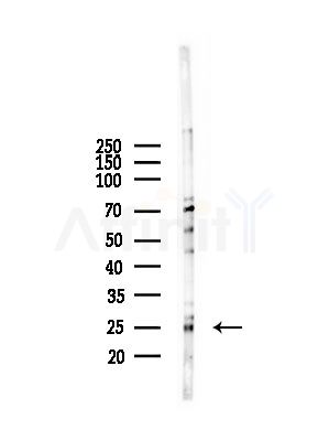 PLDN Antibody - Western blot analysis of lysates from A375 cells(starvation,24h treatment), using PLDN Antibody at 1/1000 dilution.