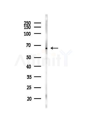 TOM70 Antibody - Western blot analysis of lysates from LoVo cells(heat-shock,45min treatment), using TOM70 Antibody at 1/1000 dilution.