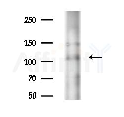 PPP1R15B Antibody - Western blot analysis of extracts from EC304 cells(heat-shock treatment), using PPP1R15B Antibody at 1/1000 dilution.