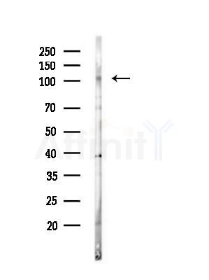 PPP1R15B Antibody - Western blot analysis of lysates from EC304 cells(heat-shock, 45min treatment), using PPP1R15B Antibody at 1/1000 dilution.