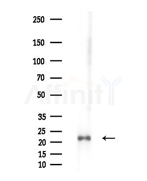 Tim23 Antibody - Western blot analysis of extracts from EC304 cells(heat-shock treatment), using Tim23 Antibody at 1/1000 dilution.