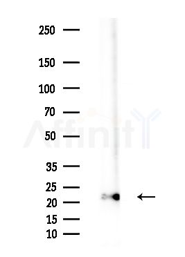 Tim23 Antibody - Western blot analysis of extracts from B16F10-LUC cells(starvation treatment), using Tim23 Antibody at 1/1000 dilution.