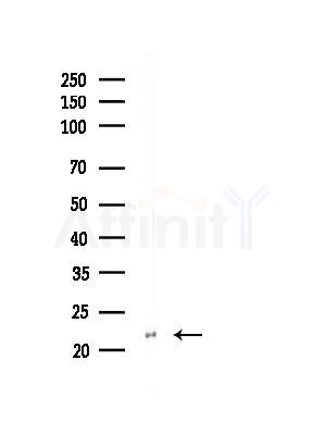Tim23 Antibody - Western blot analysis of lysates from EC304 cells(heat-shock, 45min treatment), using Tim23 Antibody at 1/1000 dilution.