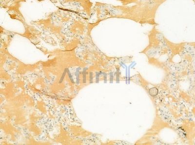 Tim23 Antibody - DF12052 at 1/100 staining human normal lung tissue by IHC-P.