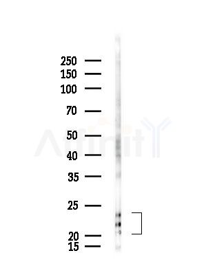 Transgelin 2 Antibody - Western blot analysis of lysates from Rat brain, using Transgelin 2 Antibody at 1/1000 dilution.