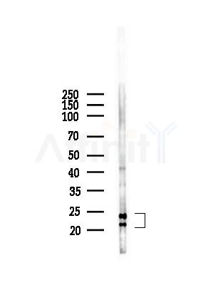 Transgelin 2 Antibody - Western blot analysis of lysates from A375 cells(starvation,24h treatment), using Transgelin 2 Antibody at 1/1000 dilution.
