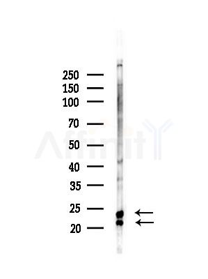 Transgelin 2 Antibody - Western blot analysis of lysates from PC12 cells(LPS, 4h treatment), using Transgelin 2 Antibody at 1/1000 dilution.