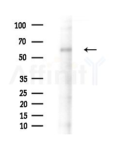 CRBN Antibody - Western blot analysis of extracts from EC304 cells(heat-shock treatment), using CRBN Antibody at 1/1000 dilution.
