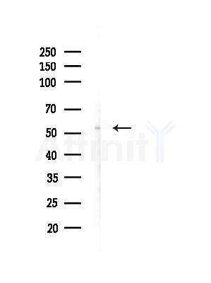 CRBN Antibody - Western blot analysis of lysates from EC304 cells(heat-shock, 45min treatment), using CRBN Antibody at 1/1000 dilution.