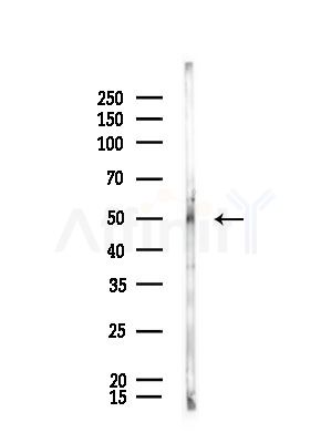 Galc Antibody - Western blot analysis of lysates from Rat brain, using Galc Antibody at 1/1000 dilution.