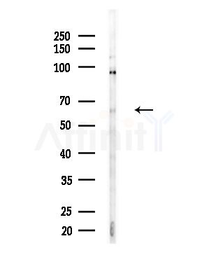 LMOD3 Antibody - Western blot analysis of lysates from COLO205 cells(heat-shock,45min treatment), using LMOD3 Antibody at 1/1000 dilution.