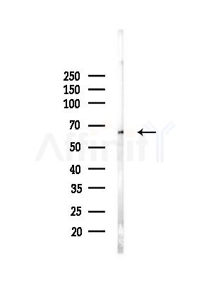 MPP5 Antibody - Western blot analysis of lysates from PC12 cells(LPS, 4h treatment), using MPP5 Antibody at 1/1000 dilution.