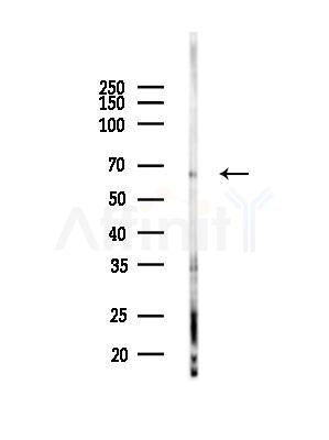 ODF2 Antibody - Western blot analysis of lysates from HUVEC cells(LPC4h treatment), using ODF2 Antibody at 1/1000 dilution.